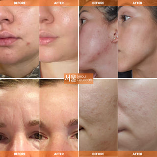 Snail Repair Cream Moisturizer