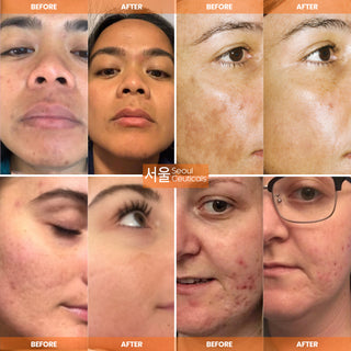 All-in-One K Beauty 5-Step Routine